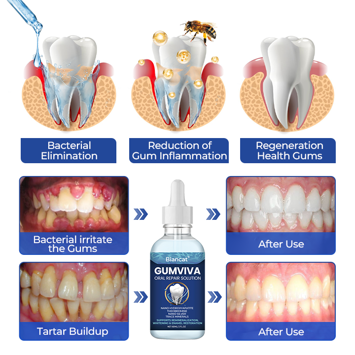 Biancat® GumViva Oral Repair Solution🔥