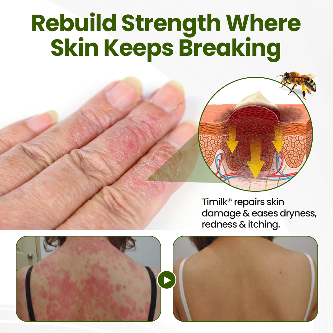 Timilk® BeePeptide RootSoft DualRelief Cream (A)