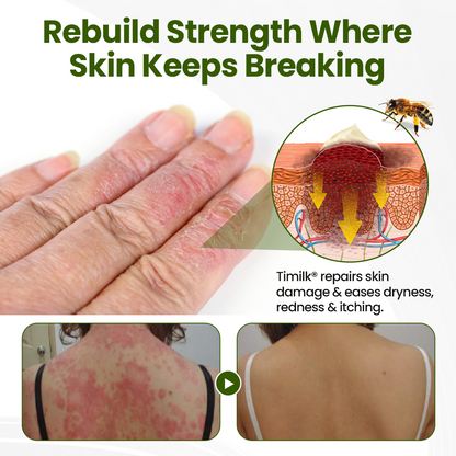 Timilk® BeePeptide RootSoft DualRelief Cream (A)