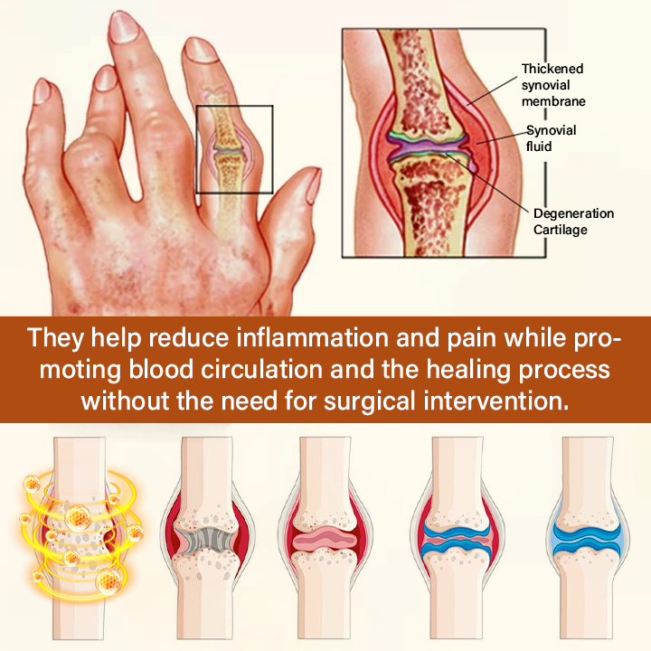Timilk® VenomEase Joint Cream (A)