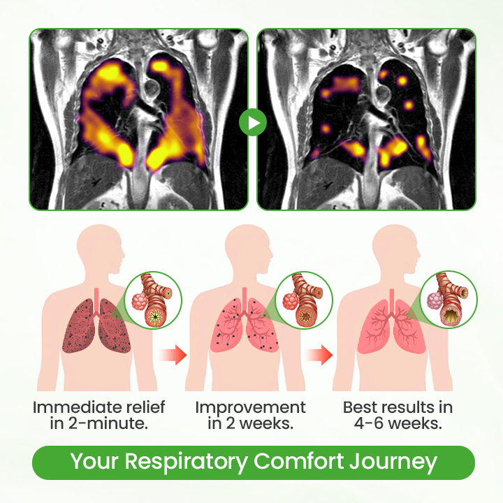 Timilk® HerbaAir Mullein Lung Purifier (new) (A)