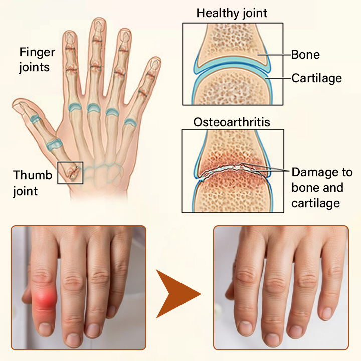 Timilk® VenomEase Joint Cream (A)