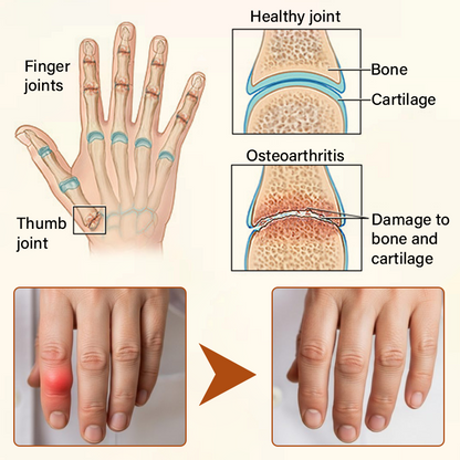 Timilk® VenomEase Joint Cream (A)