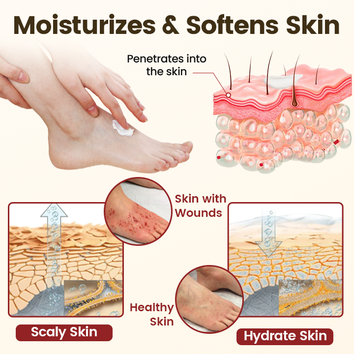 Timilk® DiaRelief Healing Cream (A)