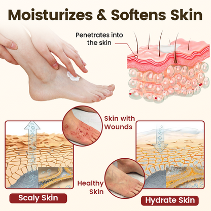 Timilk® DiaRelief Healing Cream (A)