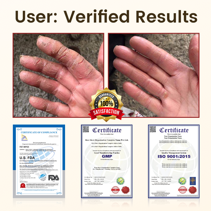 Timilk® DiaRelief Healing Cream (A)