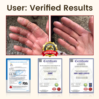 Timilk® DiaRelief Healing Cream (A)