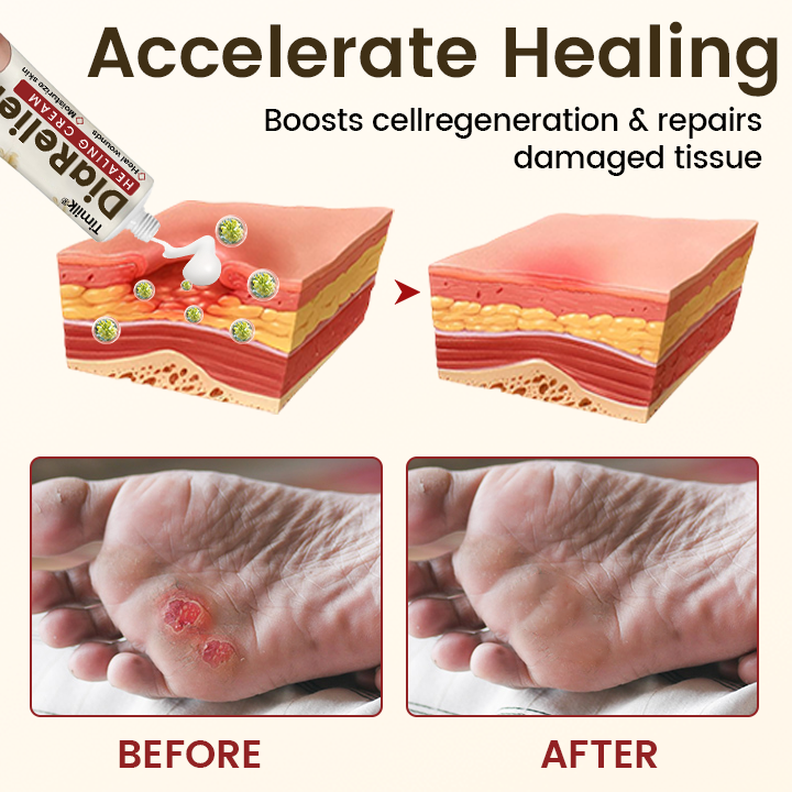 Timilk® DiaRelief Healing Cream (A)