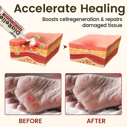 Timilk® DiaRelief Healing Cream (A)