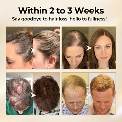 Timilk® CollagenGrow Peptides Hair Growth Spray