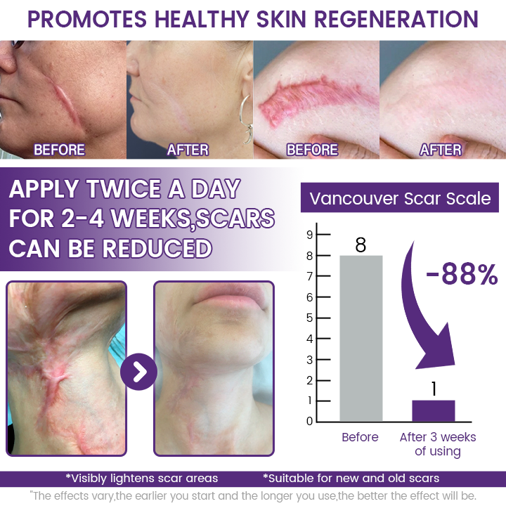 Timilk® ReGenScar Stem Cell Scar Gel