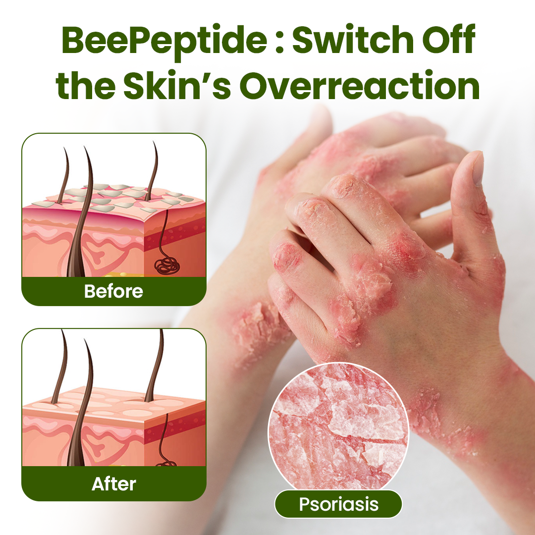 Timilk® BeePeptide RootSoft DualRelief Cream (A)