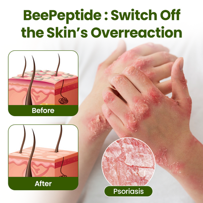 Timilk® BeePeptide RootSoft DualRelief Cream (A)