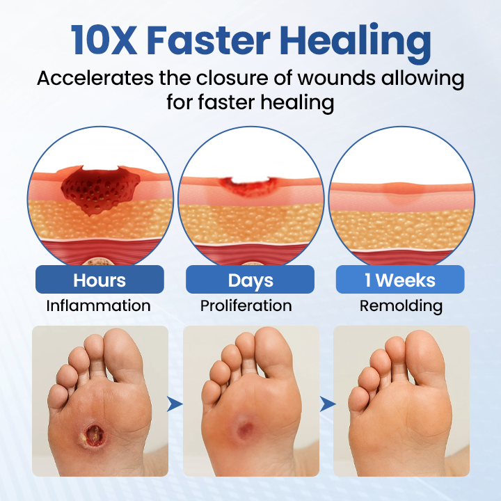 Timilk® GlucoDerm Barrier Spray(A)