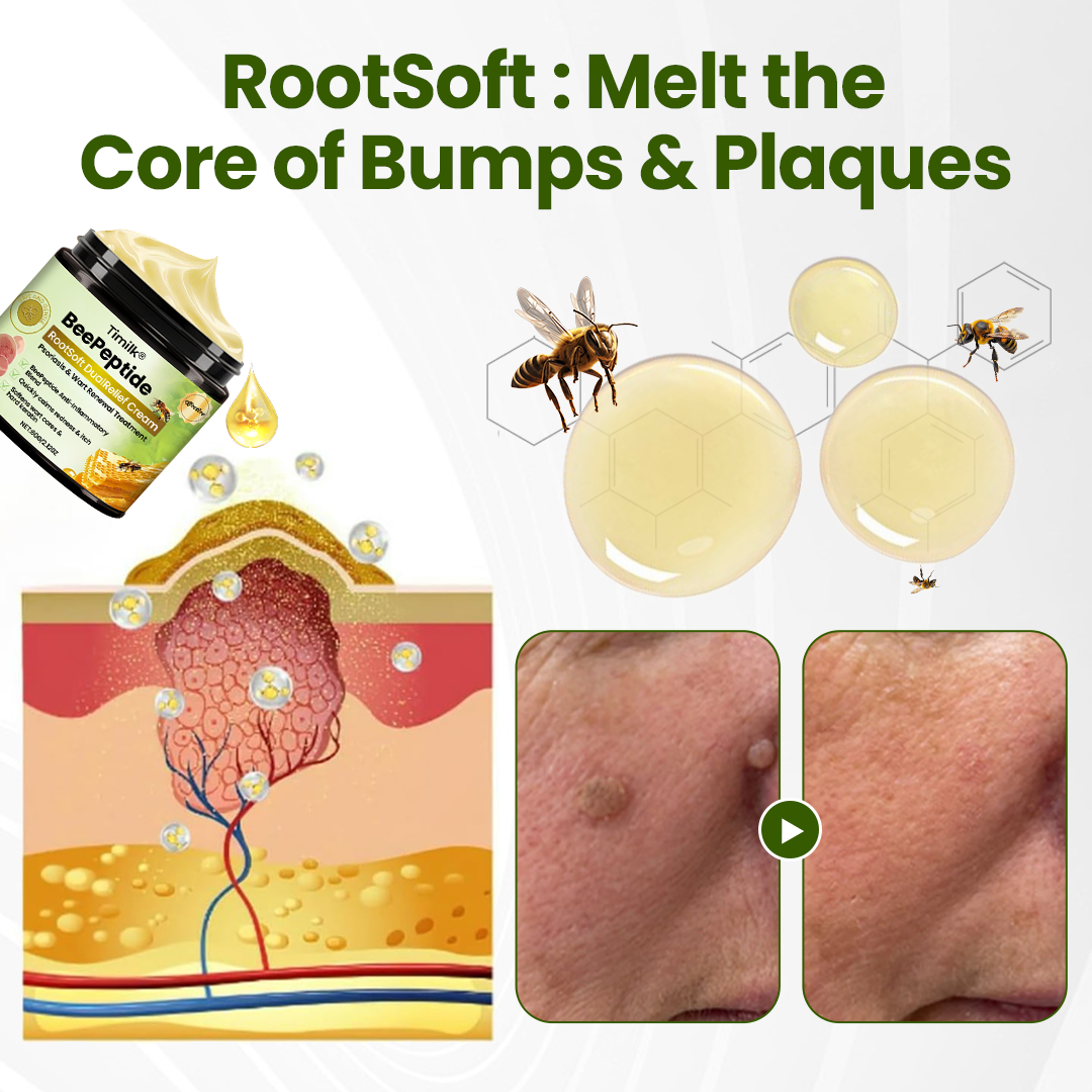 Timilk® BeePeptide RootSoft DualRelief Cream (A)