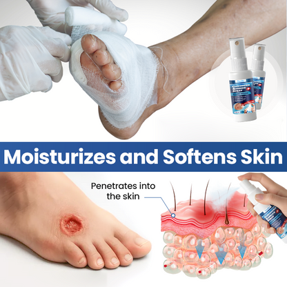 Timilk® GlucoDerm Barrier Spray(A)